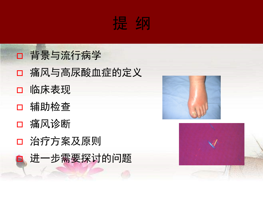 2018中国痛风临床诊治指南解读-PPT.ppt_第2页