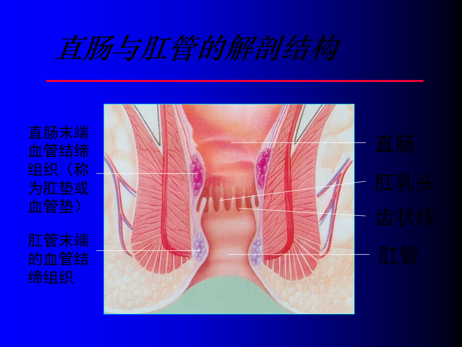 痔的套扎治疗PPT.ppt_第2页