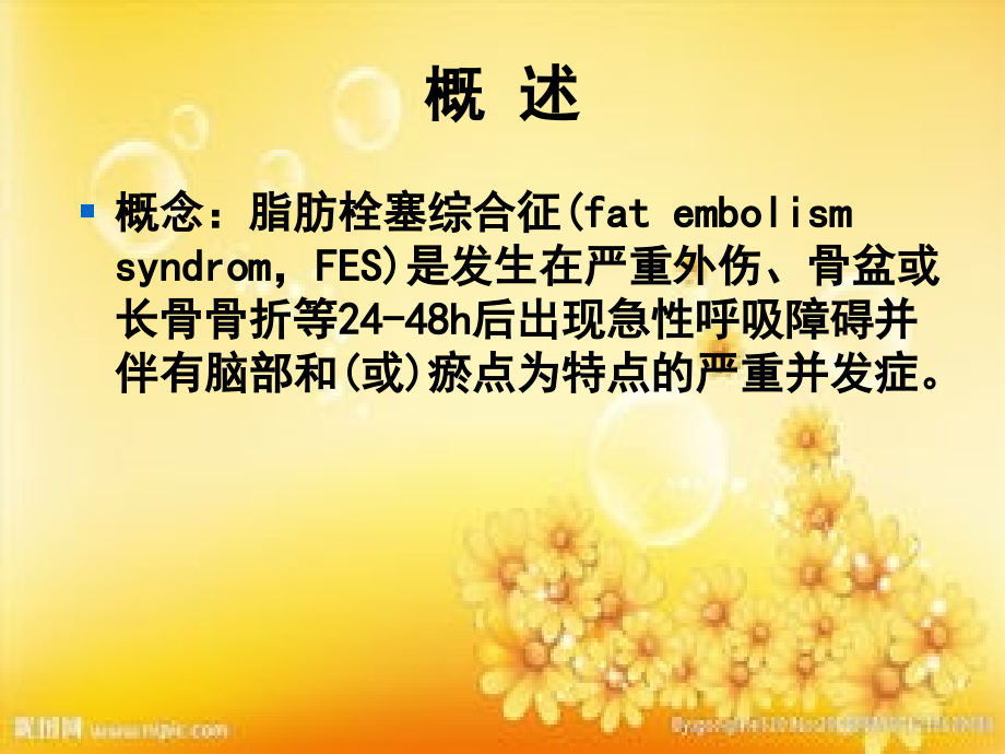脂肪栓塞综合征-(2).ppt_第2页