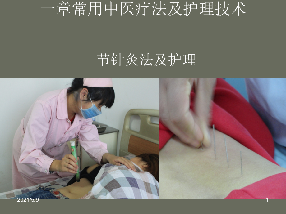 针灸法及护理.ppt_第1页