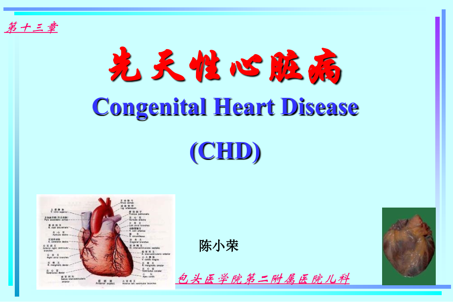 动脉导管未闭课件.ppt_第1页