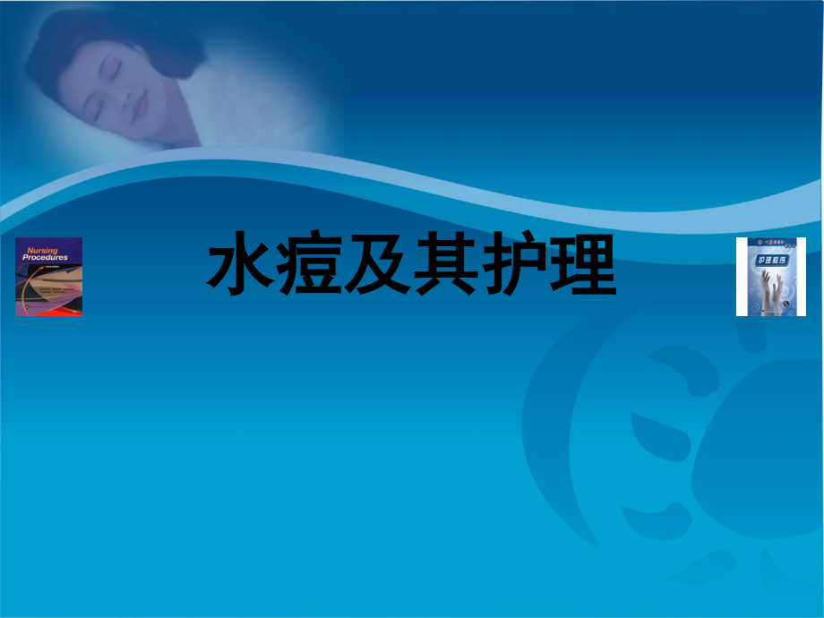 水痘及其护理.ppt_第1页