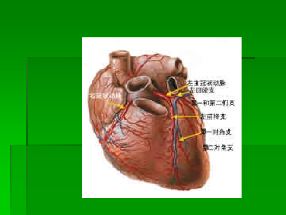 冠心病的诊断鉴别诊断防治原则.ppt_第2页