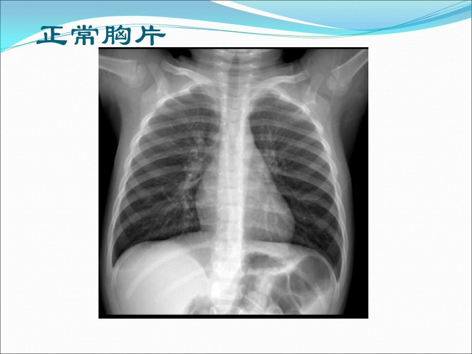 规范化培训出站考前培训影像读片ppt课件.ppt_第2页