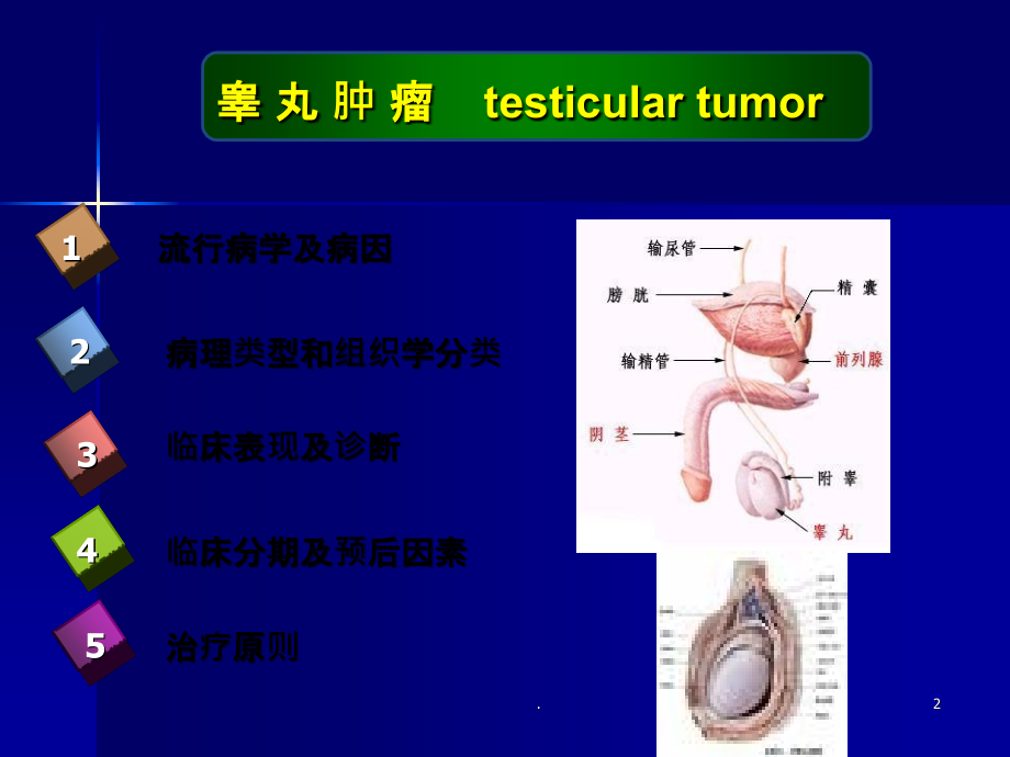 睾丸肿瘤ppt.ppt_第2页