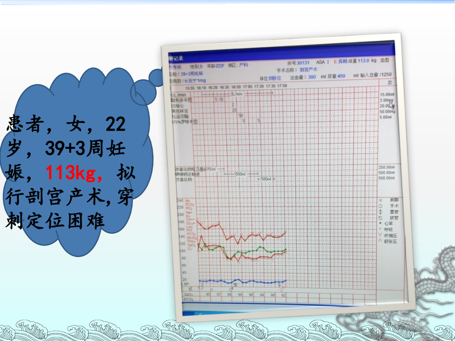 浅谈肥胖患者的麻醉处理.ppt_第1页