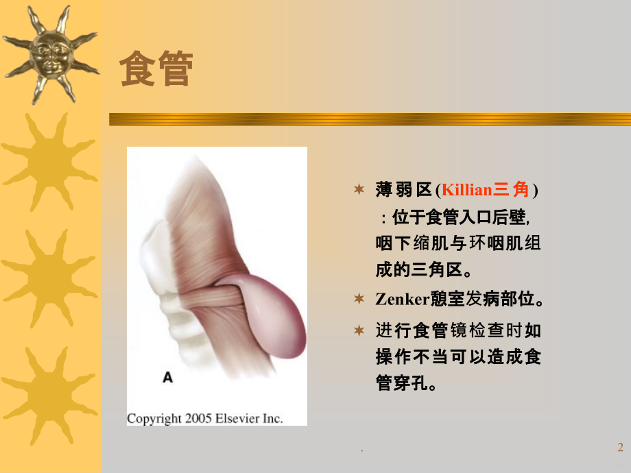 食管异物护理查房.ppt_第2页