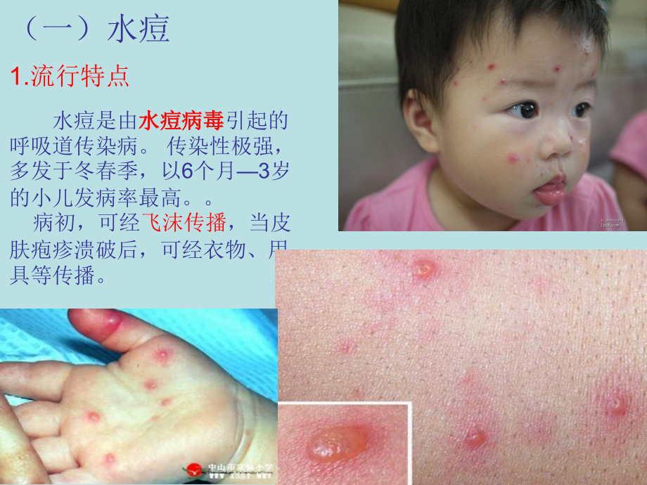 传染病种类.ppt_第2页