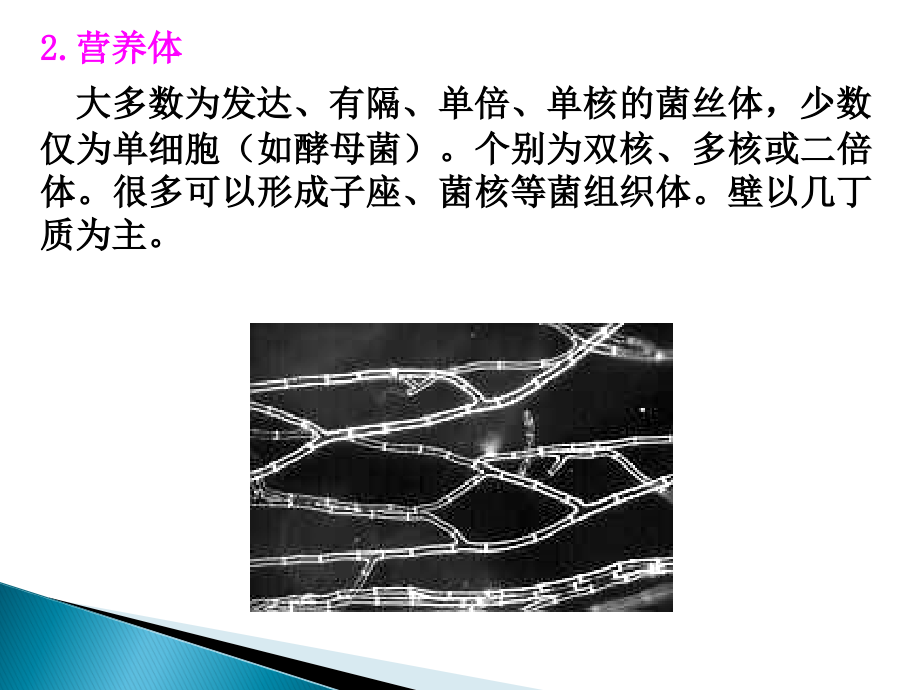 普通植物病理学真菌子囊菌ppt课件.ppt_第2页