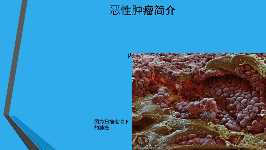 肿瘤治疗与进展简介课件.ppt_第1页