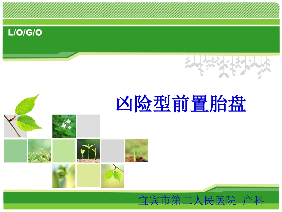 凶险性前置胎盘的诊治.ppt_第1页