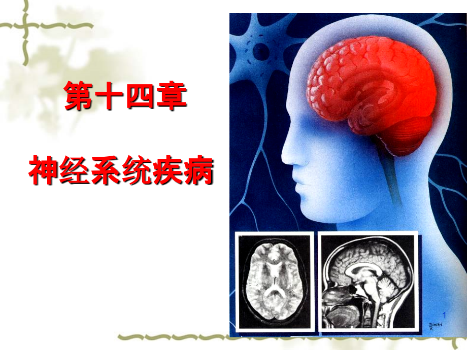 流脑乙脑.ppt_第1页