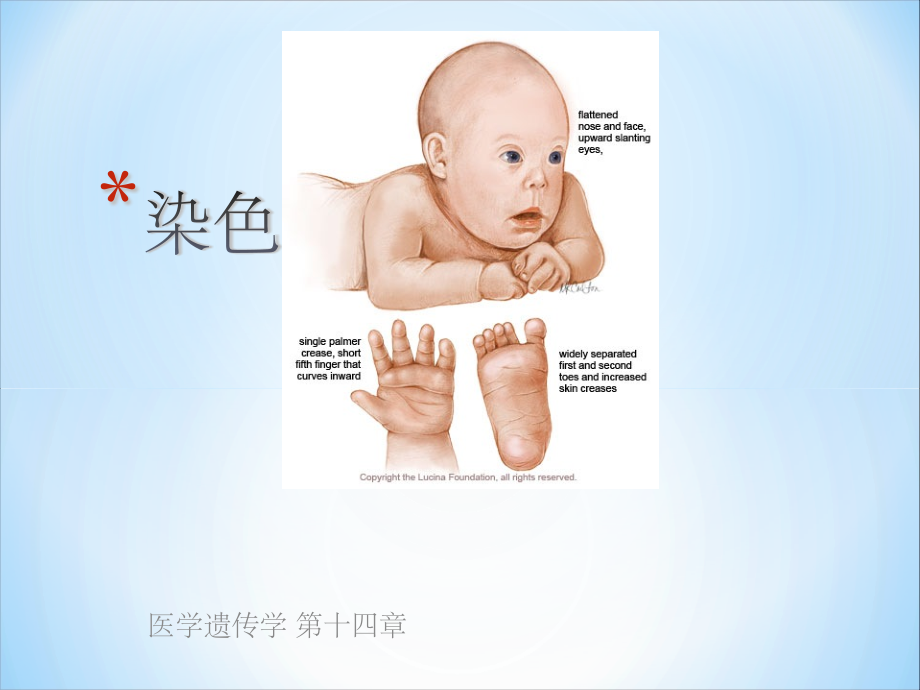 染色体病-(3).ppt_第2页