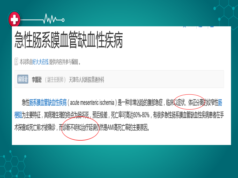急性肠系膜血管缺血性疾病ppt课件.ppt_第2页