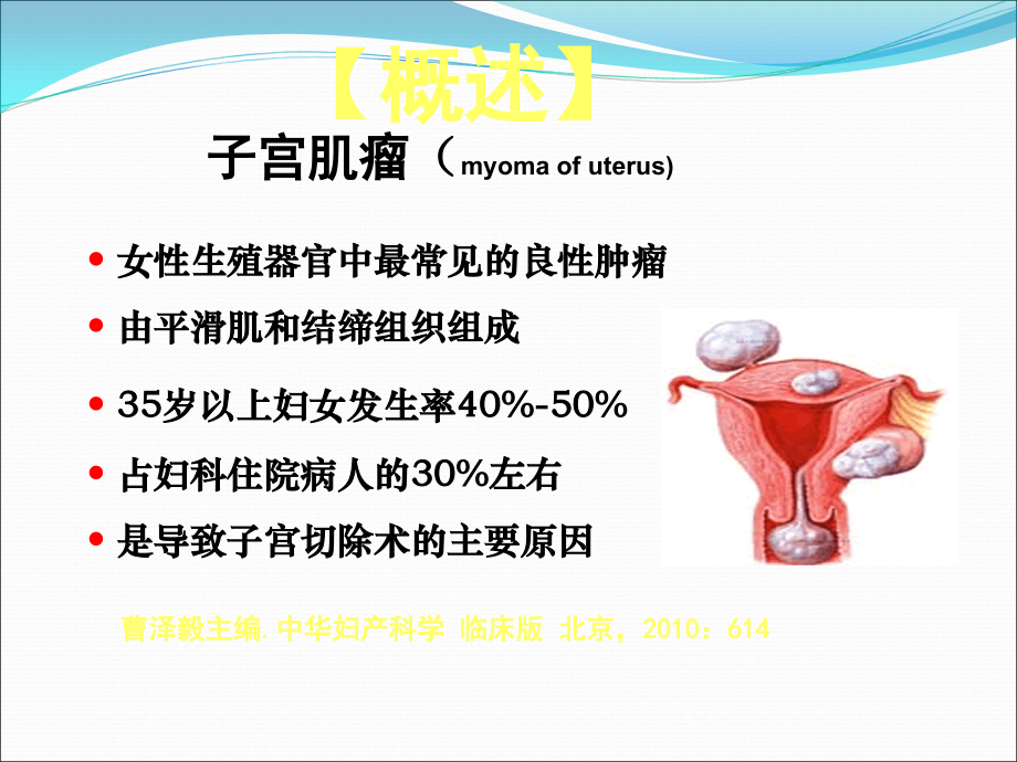 子宫肌瘤诊治ppt课件.ppt_第2页