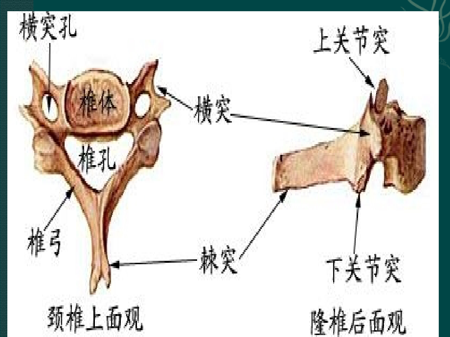 颈椎影像解剖学.ppt_第2页