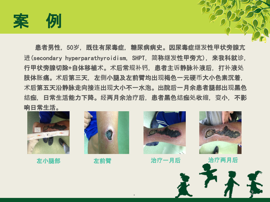 降低高渗性药物输液外渗与静脉炎的持续质量改进ppt课件.ppt_第2页
