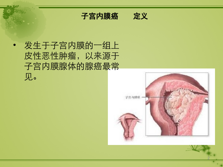 子宫内膜癌病人护理.ppt_第2页