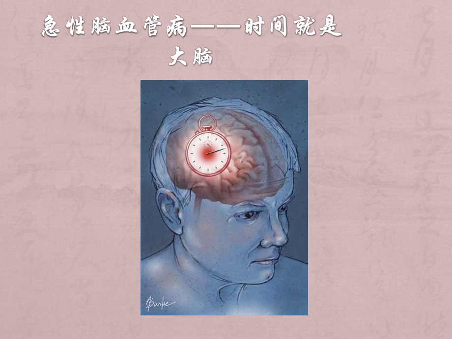 急性脑卒中救治方案.ppt_第2页