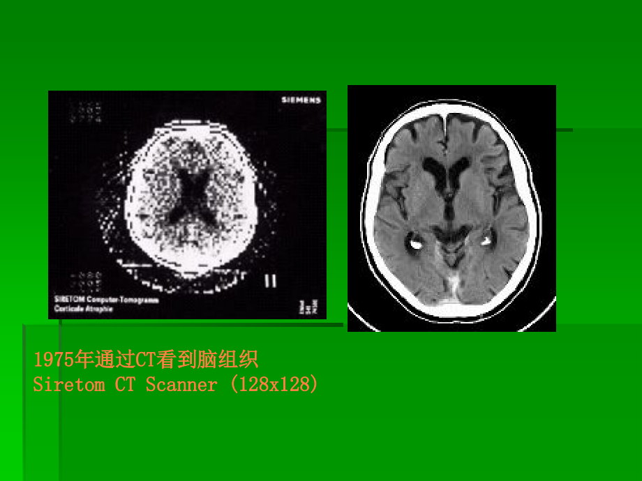 颅内常见疾病的CT表现.ppt_第2页