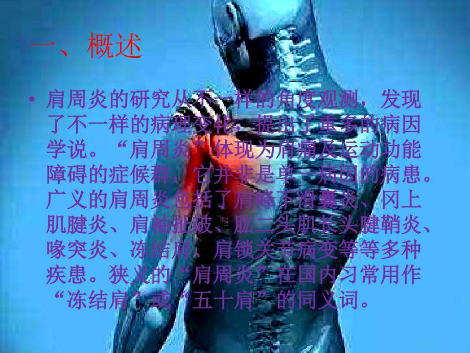 详解肩关节活动受限自我康复训练.pptx_第2页