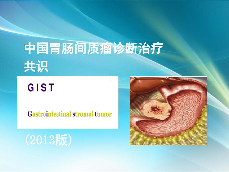 胃间质瘤专家共识的解读.ppt_第1页