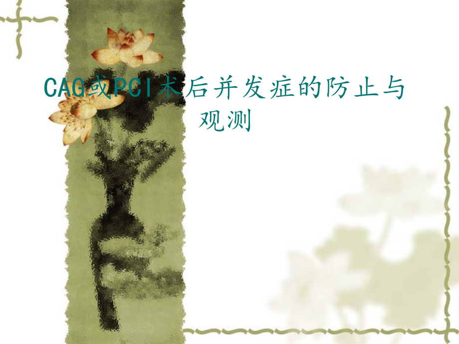 PCI术患者护理.pptx_第1页