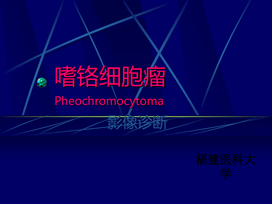 嗜铬细胞瘤影像诊断版本.ppt_第1页