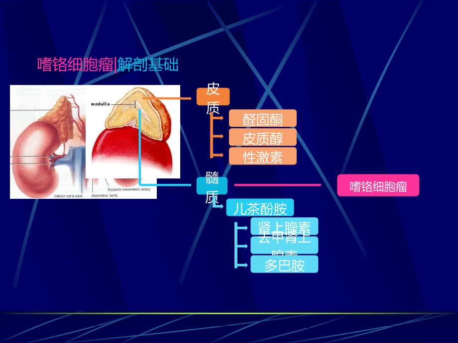 嗜铬细胞瘤影像诊断版本.ppt_第2页