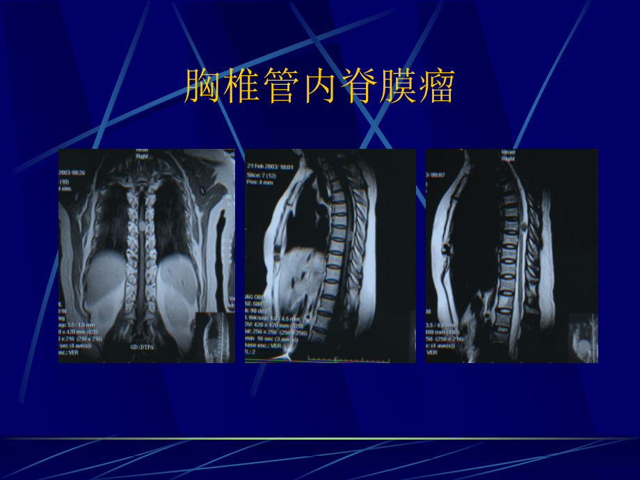 慢性疼痛的治疗.ppt_第1页