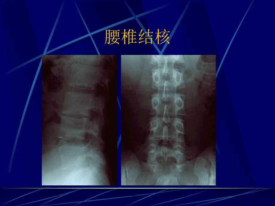 慢性疼痛的治疗.ppt_第2页
