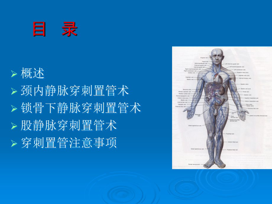 中心静脉穿刺置管术-.ppt_第2页