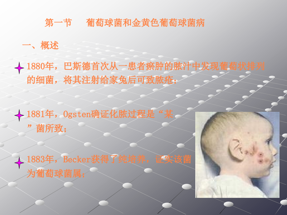 食品微生物第十二章常见致病G-资料.ppt_第2页
