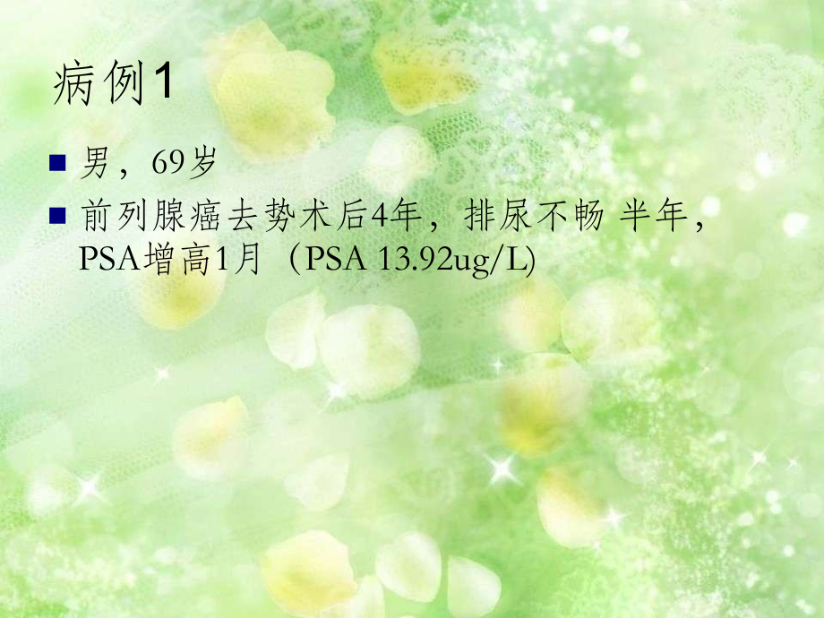 胆碱-E-C-前列腺癌.ppt_第1页