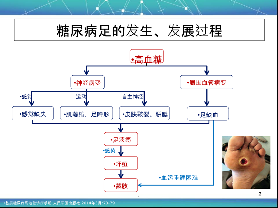 中国糖尿病足诊治指南ppt课件.ppt_第2页