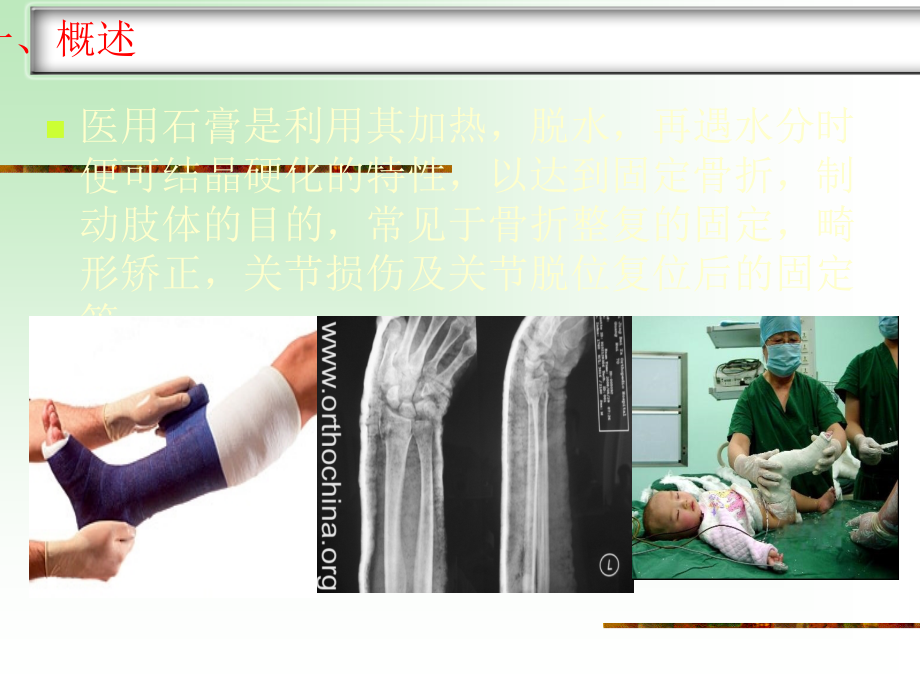 石膏固定患者的护理.ppt_第2页
