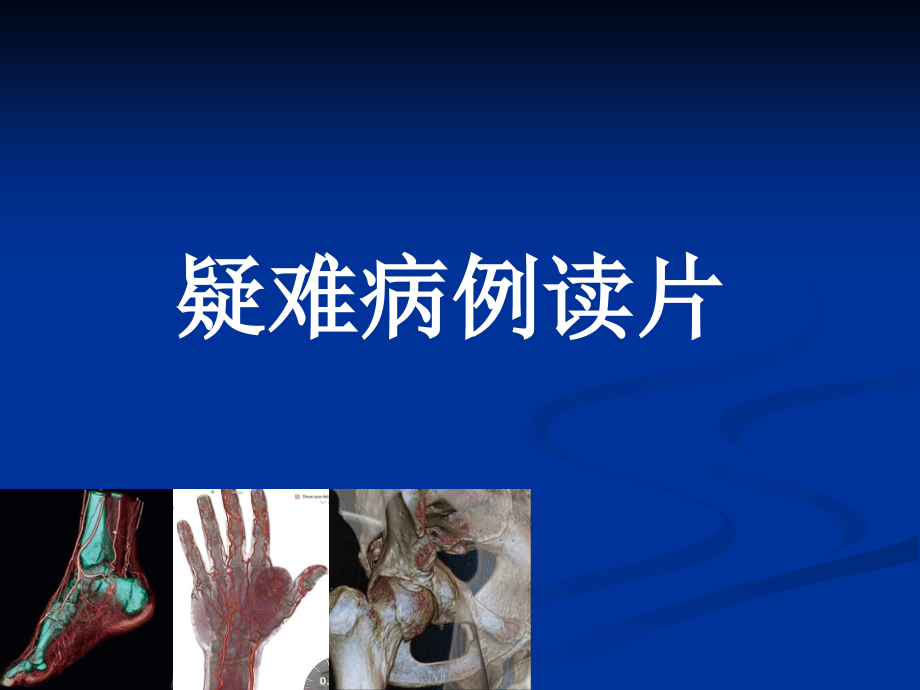 疑难病例读片.ppt_第1页