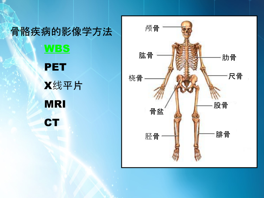 全身骨显像骨显像---核医学.ppt_第2页
