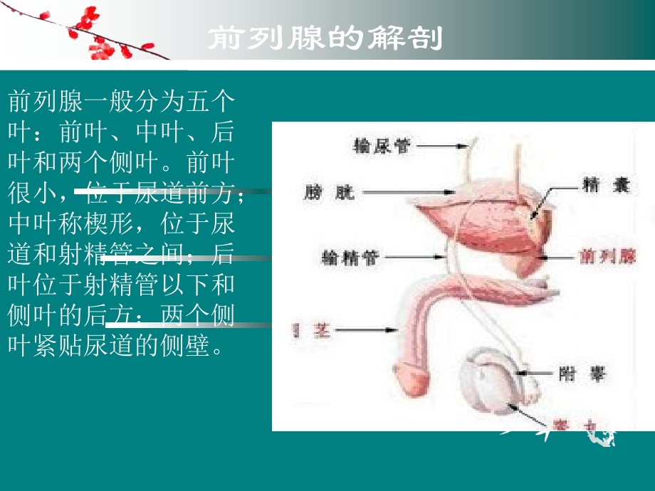 直肠B超引导下经会阴前列腺癌近距离治疗术的手术配合.ppt_第2页