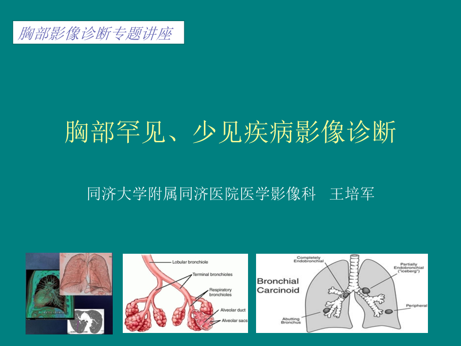 胸部少见、罕见疾病影像诊断.ppt_第1页