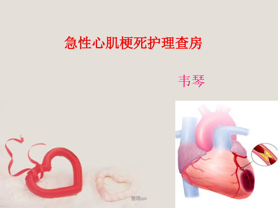 心肌梗死a.ppt_第1页