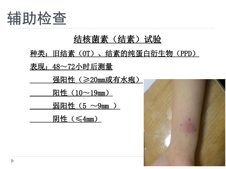 病理学专升本资料：病理学--结核病.ppt_第2页