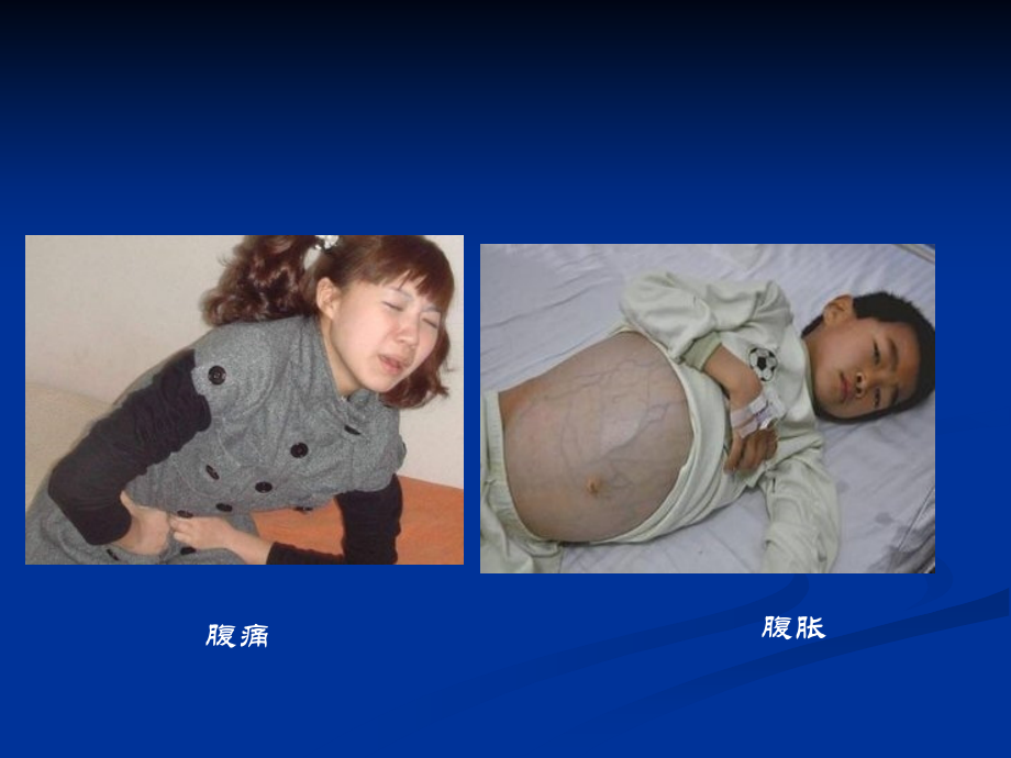 诊断学课件：第三篇 体格检查 第六章 腹部检查.ppt_第2页