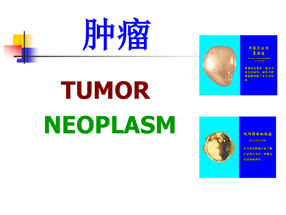 病理学课件：5 肿瘤 3.ppt_第1页