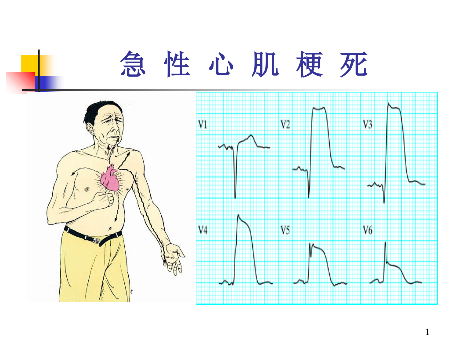 心电图诊断1--基础和正常(HJ)课件.ppt_第1页