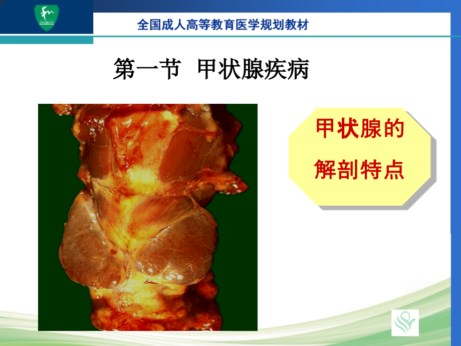 第13章-内分泌系统常见疾病课件.ppt_第2页