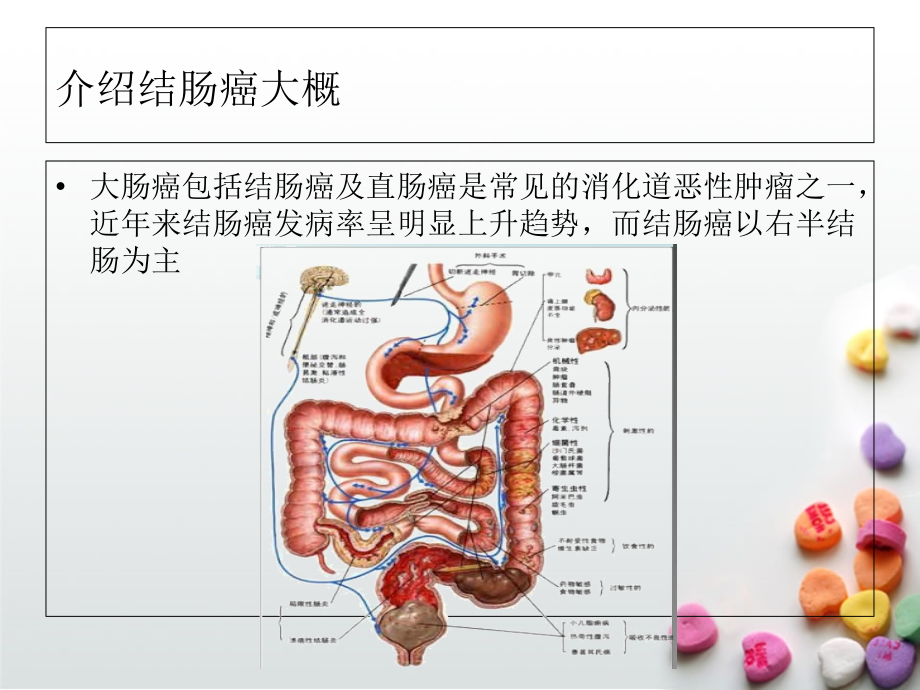 恶性肿瘤病人常见症状的护理课件.ppt_第2页