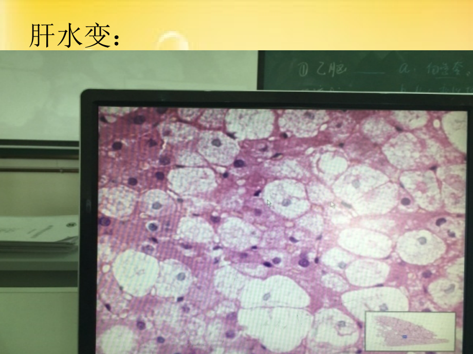 病理学实验切片考试图片.ppt_第1页