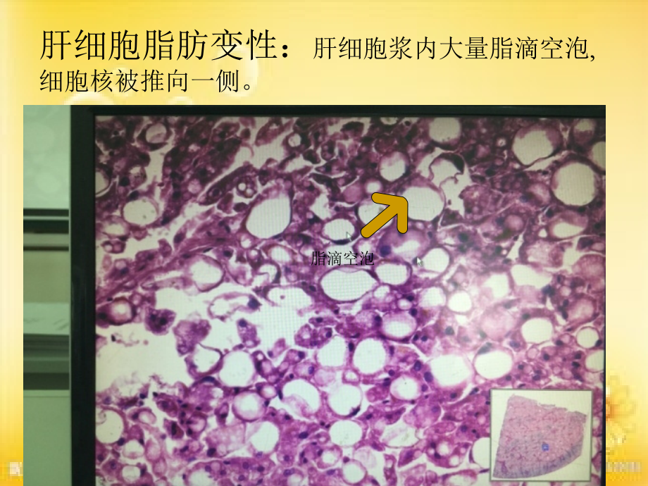病理学实验切片考试图片.ppt_第2页