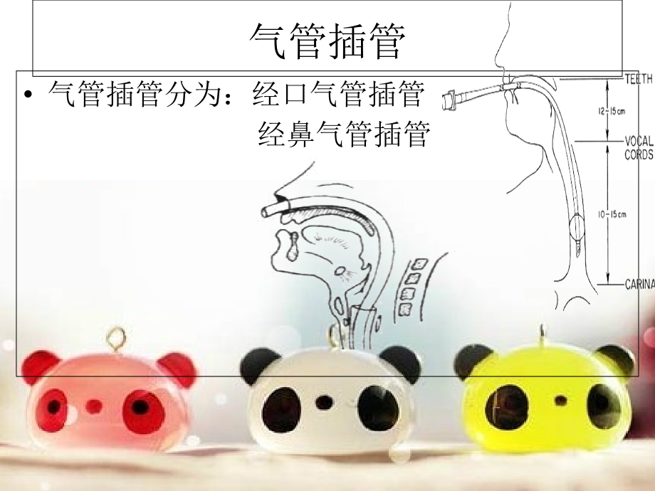气管插管病人的护理课件.ppt_第1页